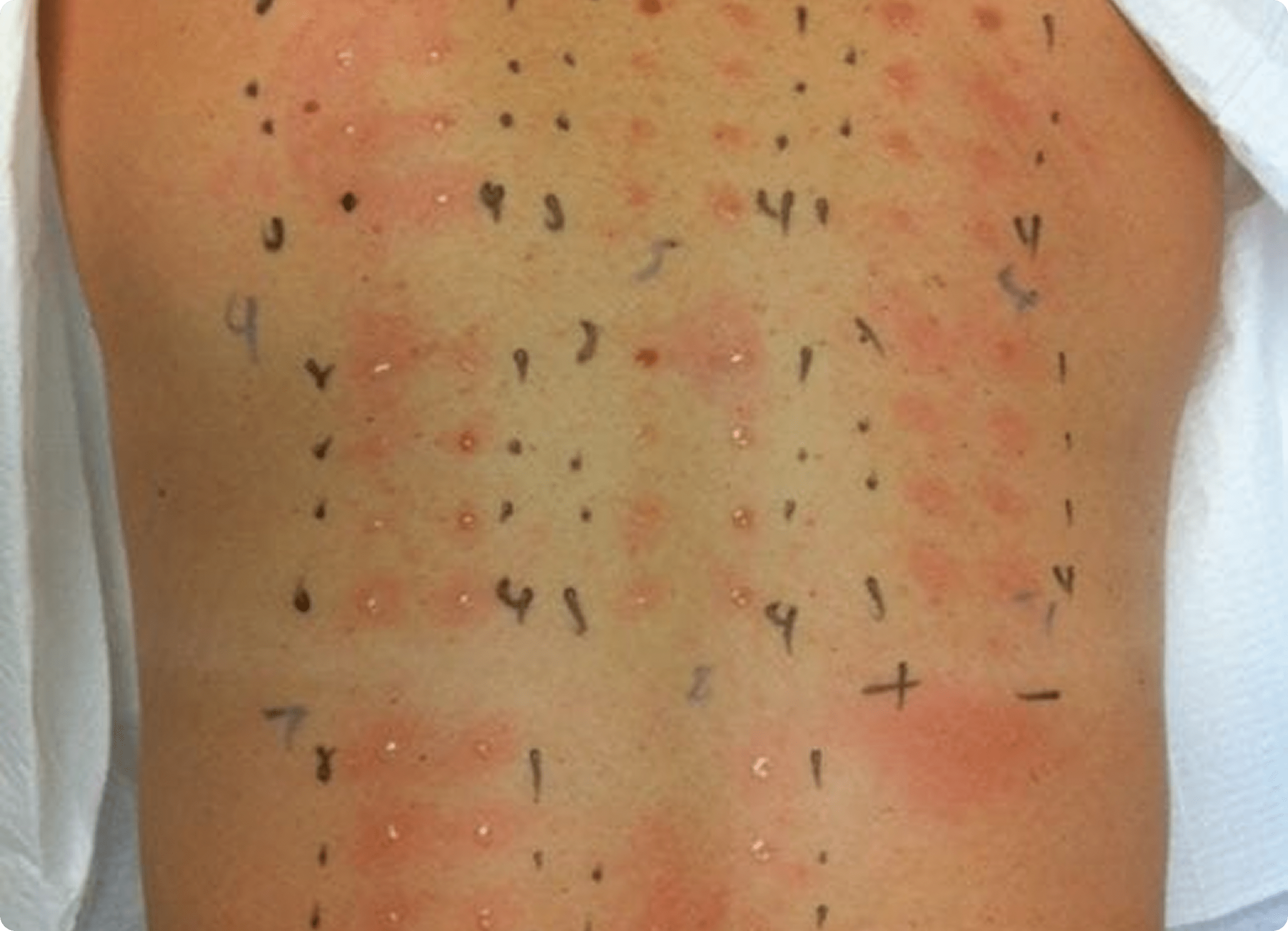 Our Solutions | Discover Effective Allergy Solutions — Universal ...