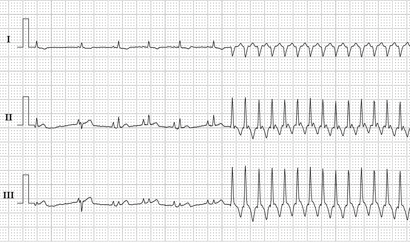 Elektrokardiogramm (EKG) mit drei (von sieben) Ableitungen bei einer Katze.