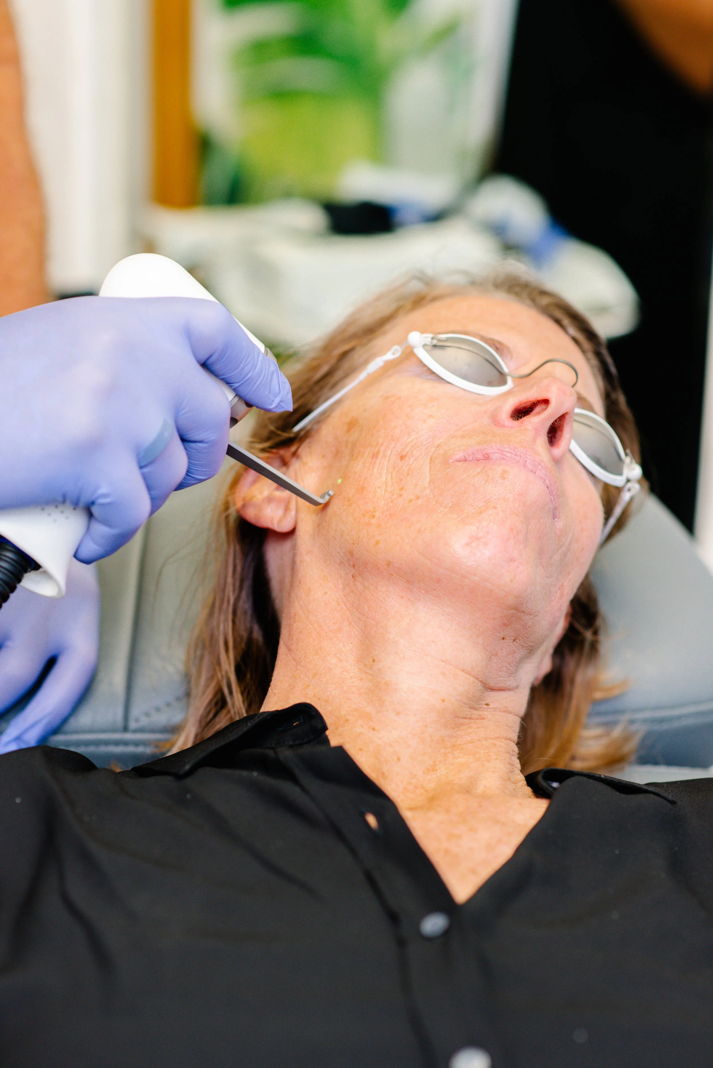 Expanding Treatment Possibilities: One Laser for a Diversity of Skin Types