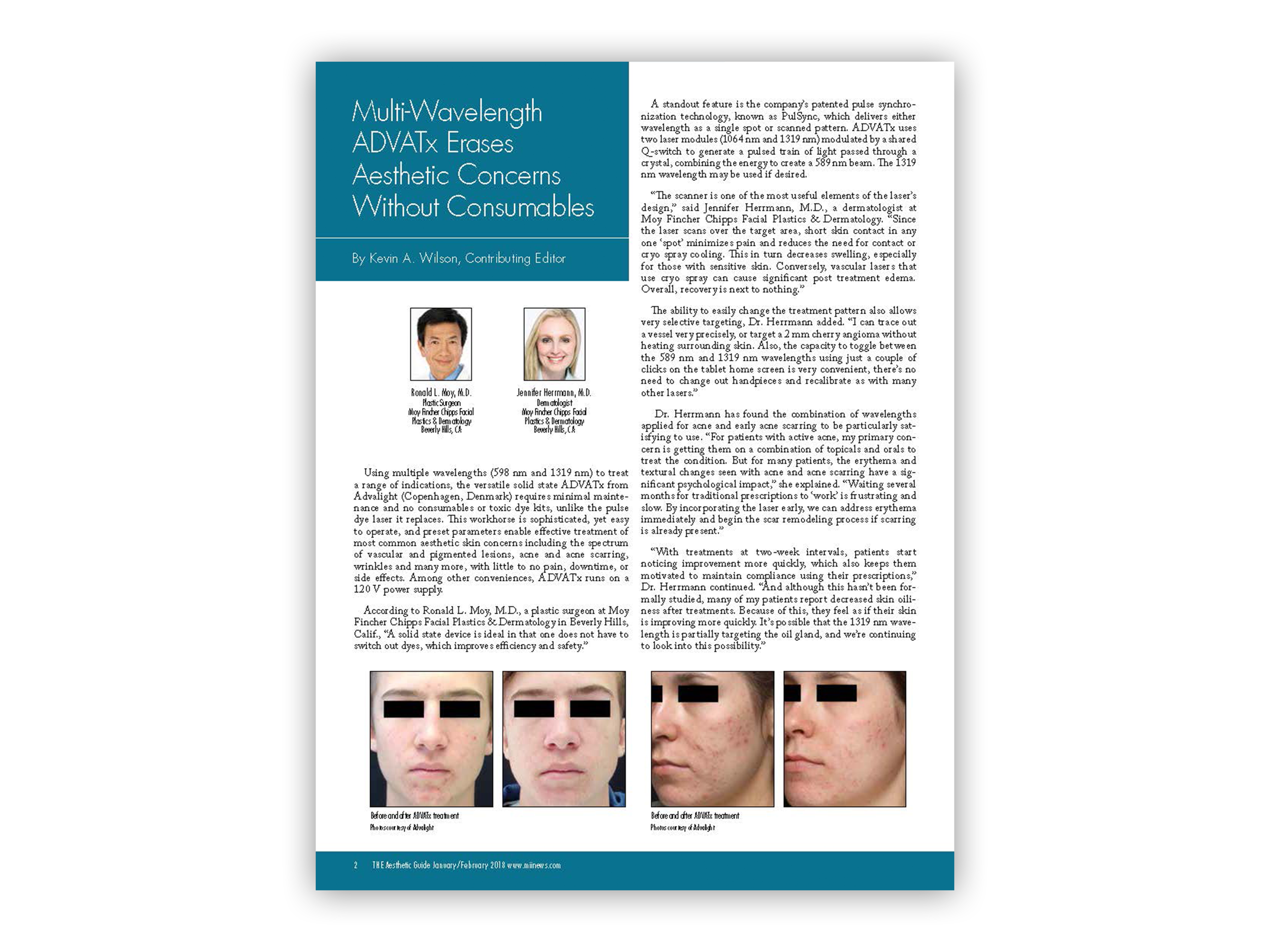 Multi-Wavelength ADVATx® Erases Aesthetic Concerns Without Consumables