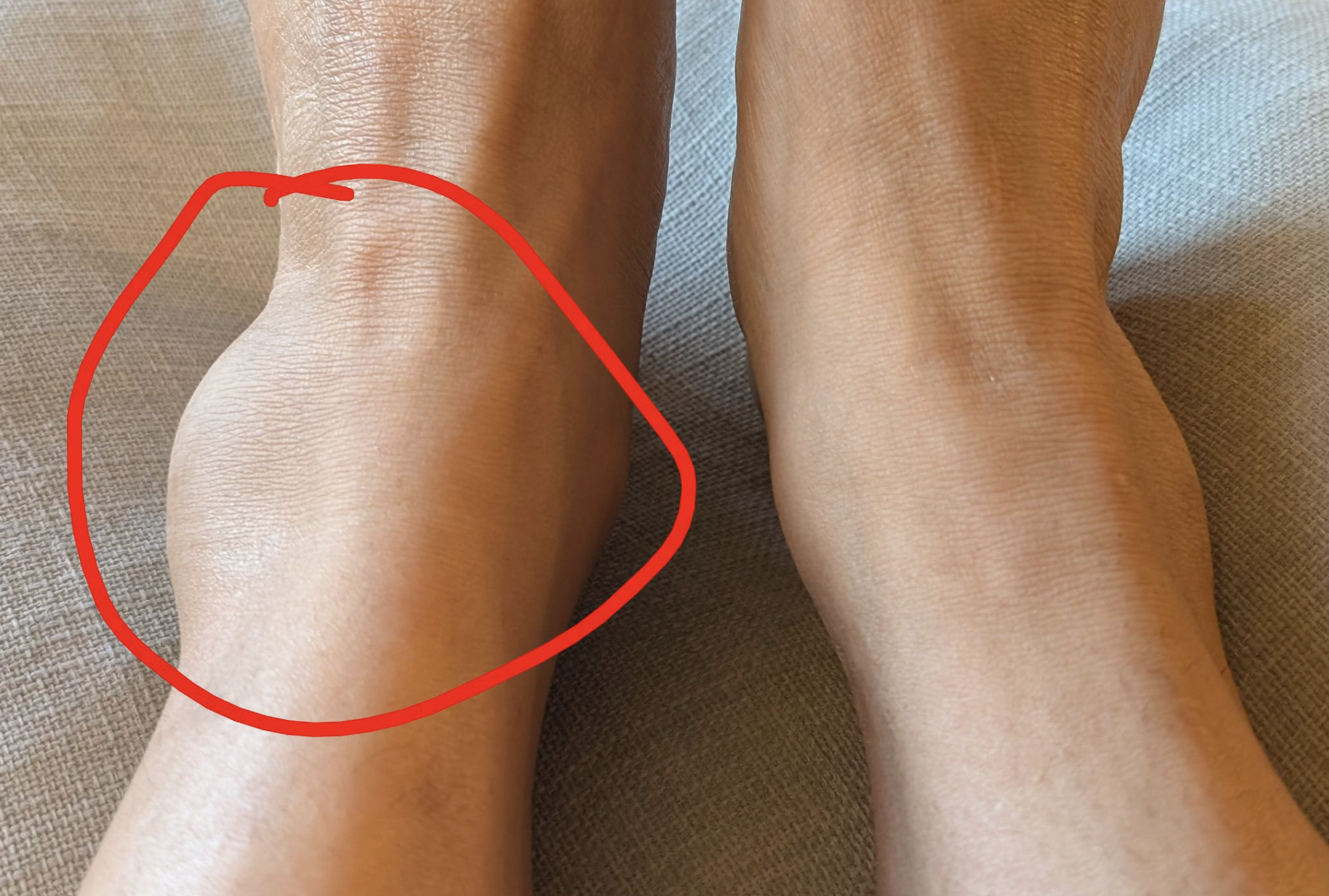 A Wrinkle in the Plans...