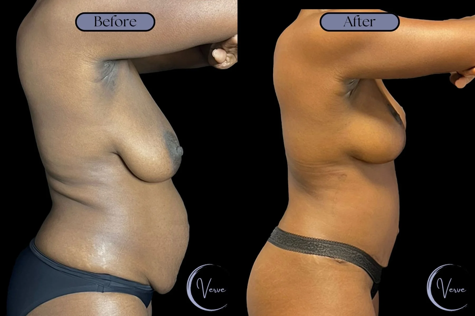 Before and After Template (Horizontal) (1).jpg