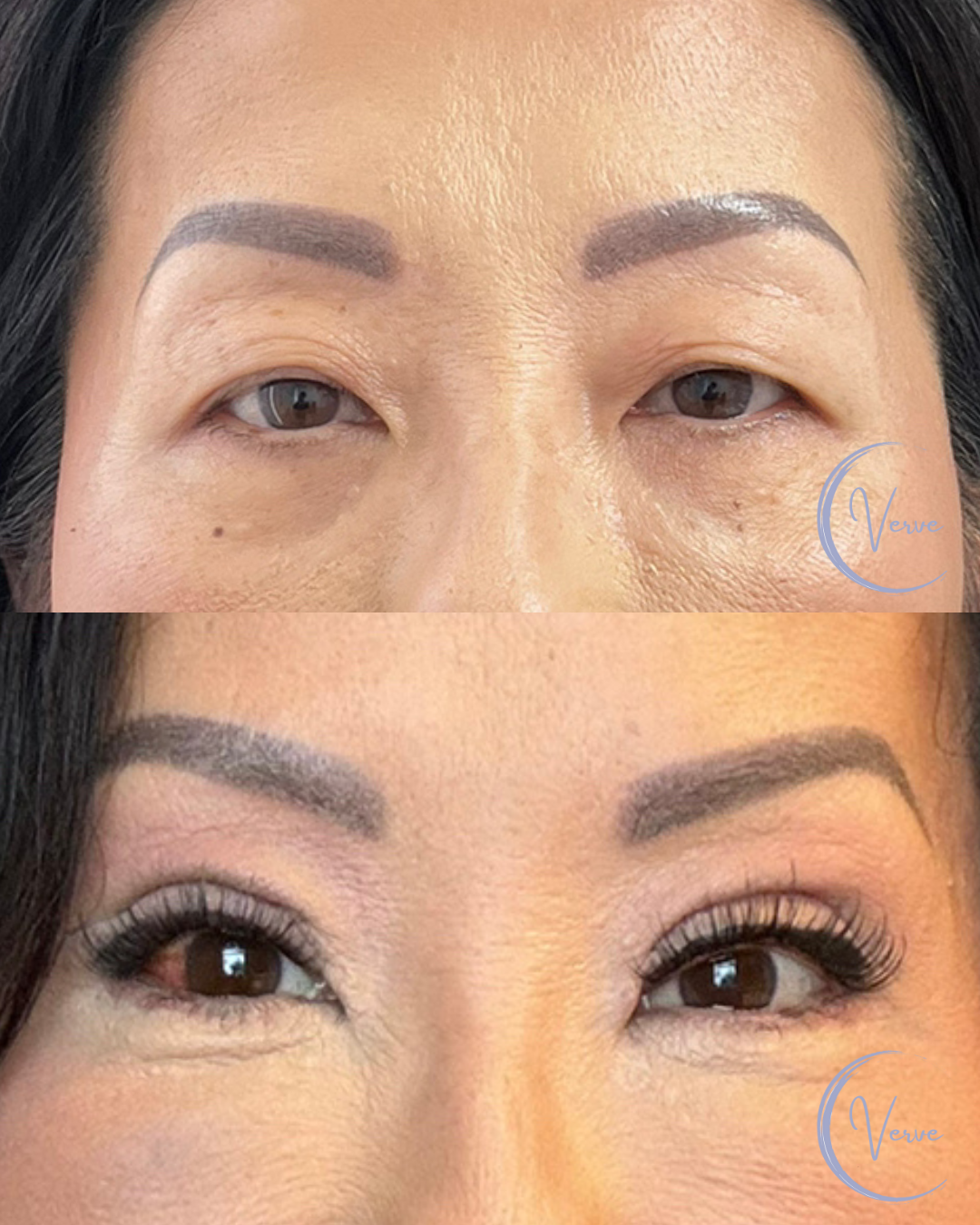 Before and After Template (Vertical).png