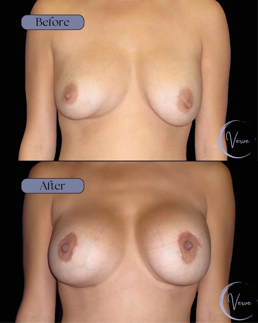 B&A (11).jpg