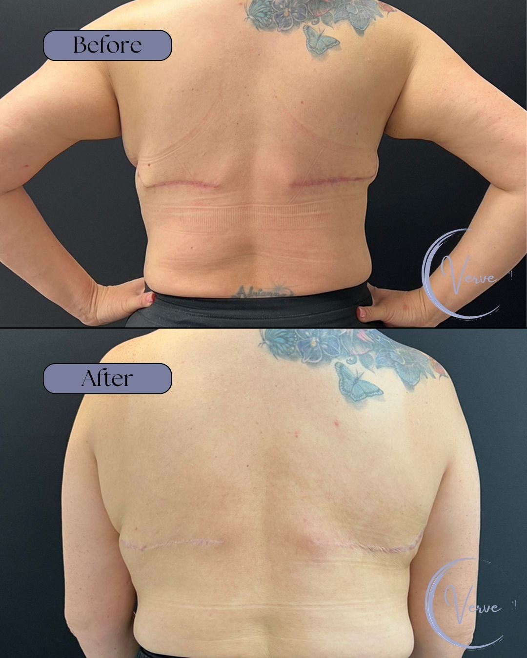 Back Before and After.jpg