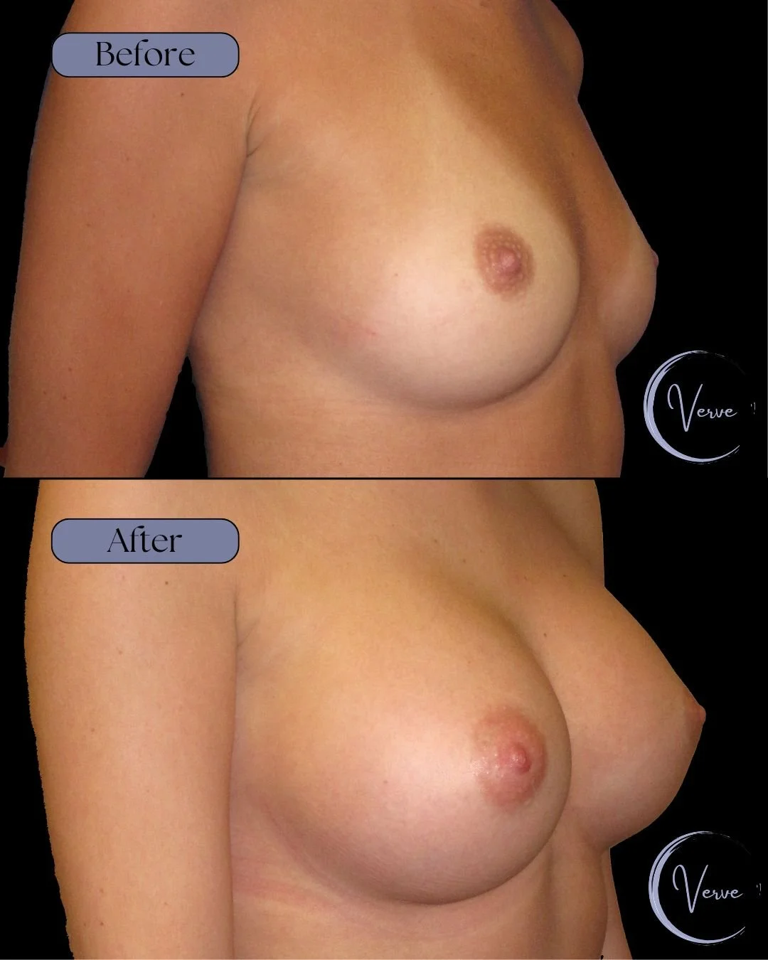 B&A (6).jpg