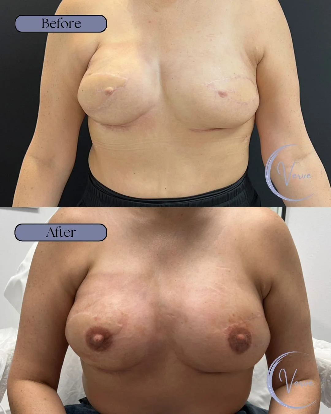 Before and After Template (Vertical).jpg