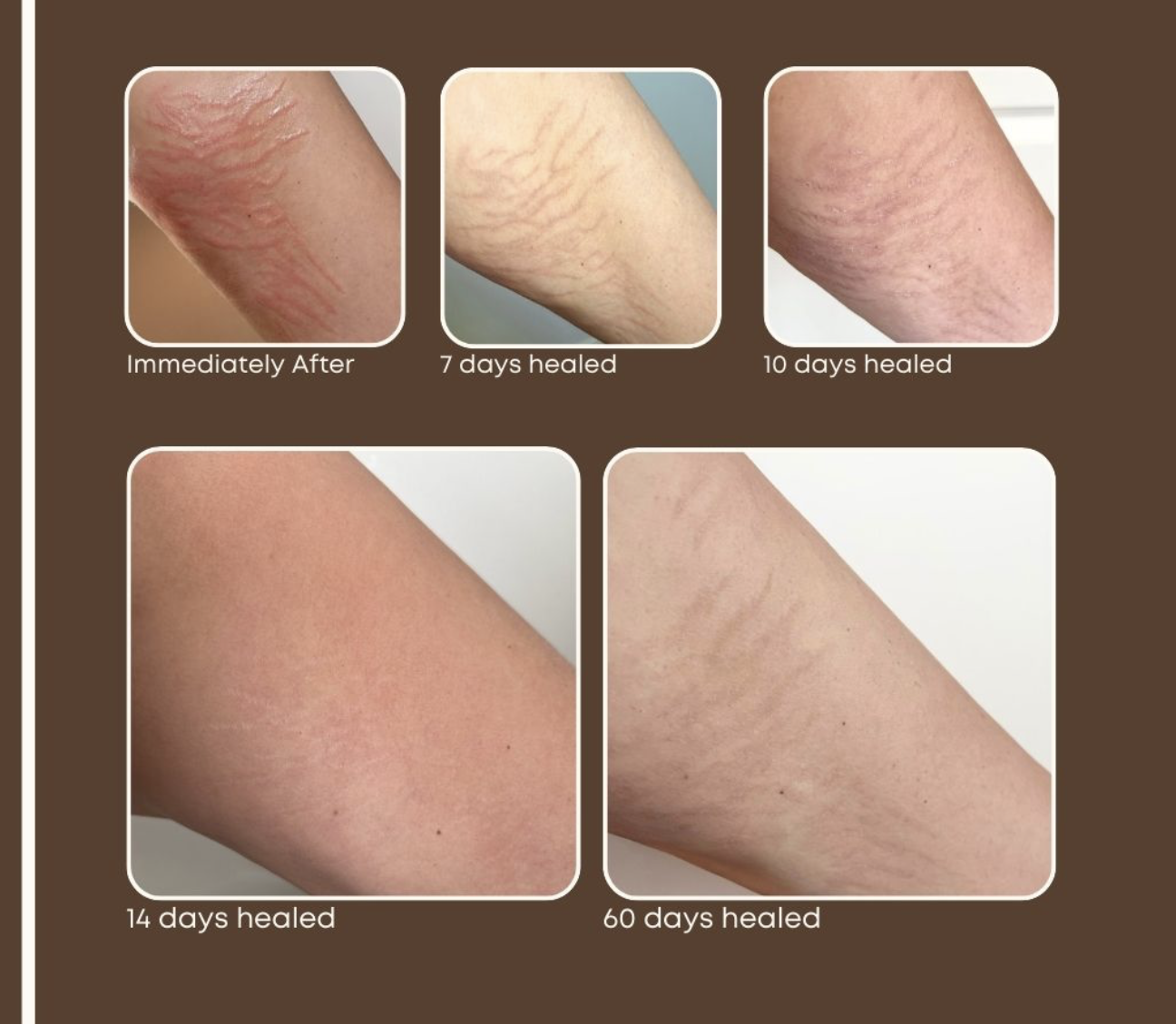 Screenshot 2025-08-07 at 11.55.42 AM.png