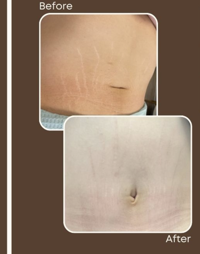 Screenshot 2025-08-07 at 11.56.06 AM.png