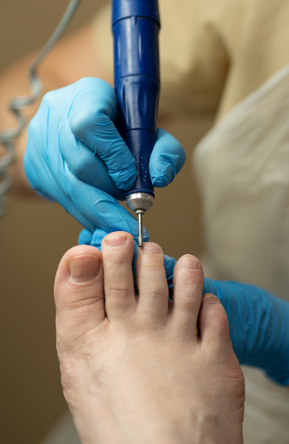 general nail and skin care, podiatry, podiatric care, toenails care, ingrown toenails, cracked heels, dry heels