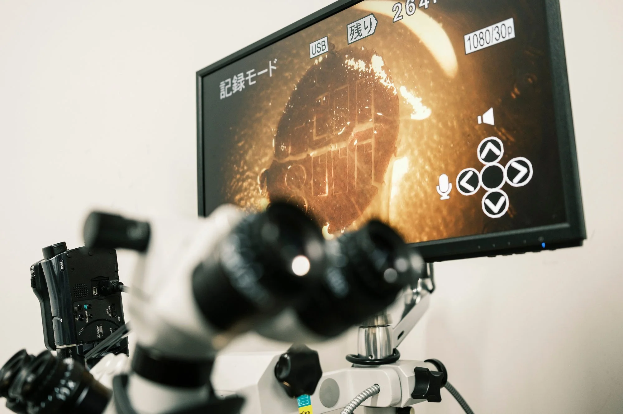 Close-up of a microscope and computer monitor displaying retinal cells. The monitor shows recording options and controls overlayed on the image.