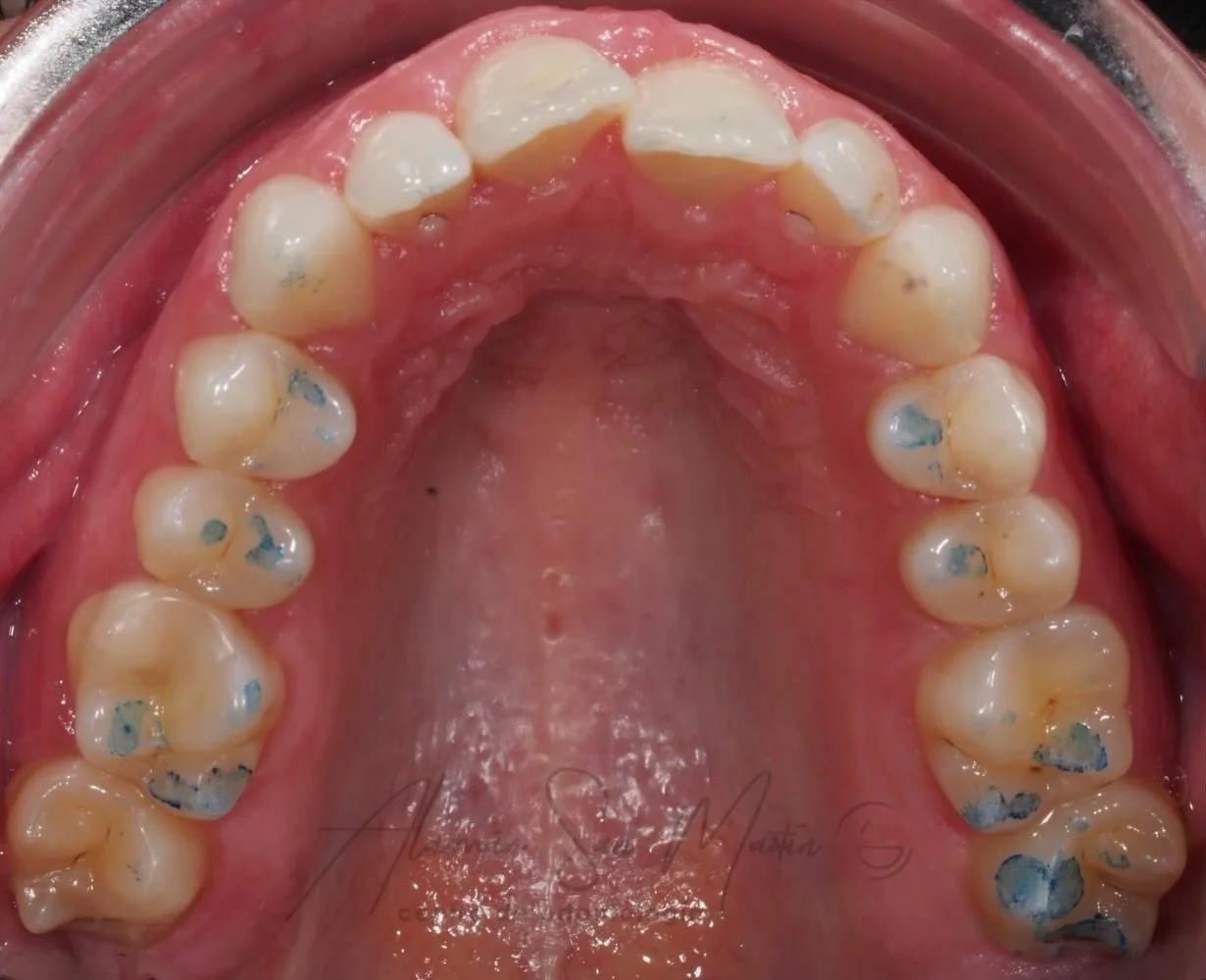 &iquest; Llevas tiempo pensando en arreglar tu sonrisa &hellip; pero sigues posponi&eacute;ndolo ? 💭😁

Este puede ser el momento que estabas esperando ! 
Ponte en contacto con nosotros en el 912009214 ☎️✨