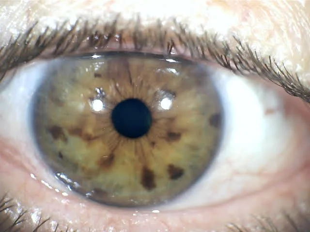 Close-up of a human eye showing brown iris and pupil.