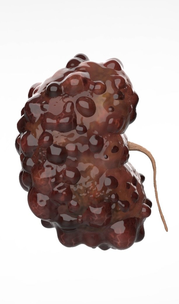 izzyfinal mid stage kidney.47.jpeg
