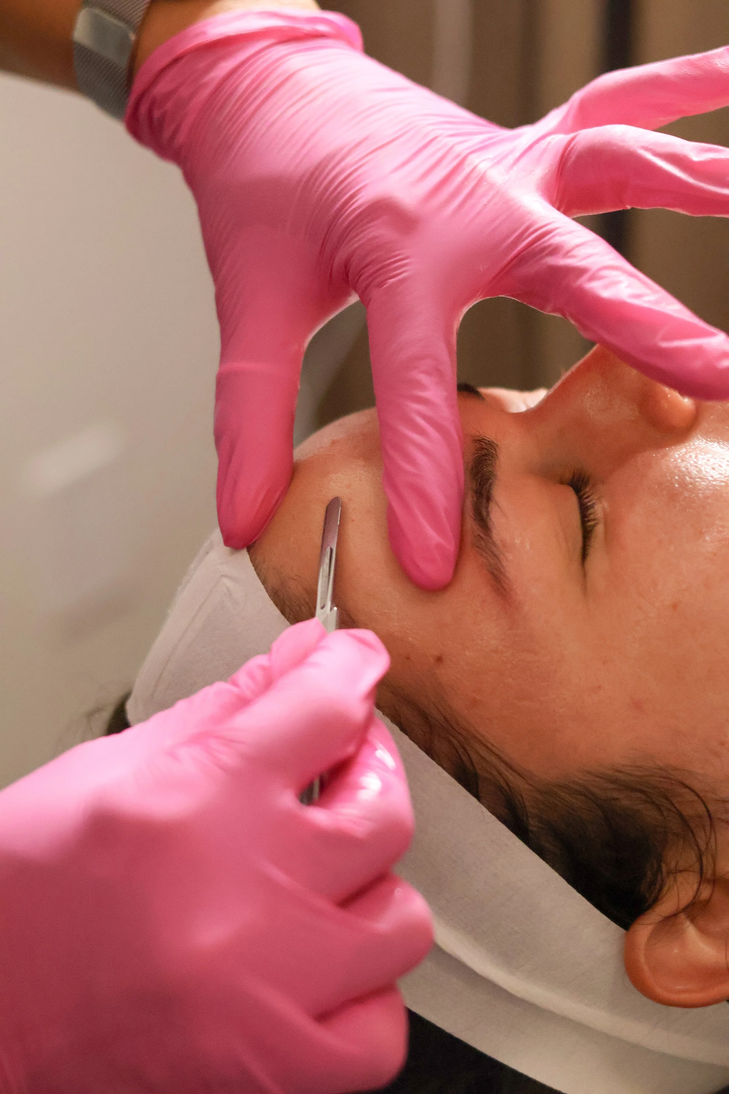 A woman is lying on a medical chair with a white pillow under her head, receiving a cosmetic injection around her face from a professional wearing black gloves.
