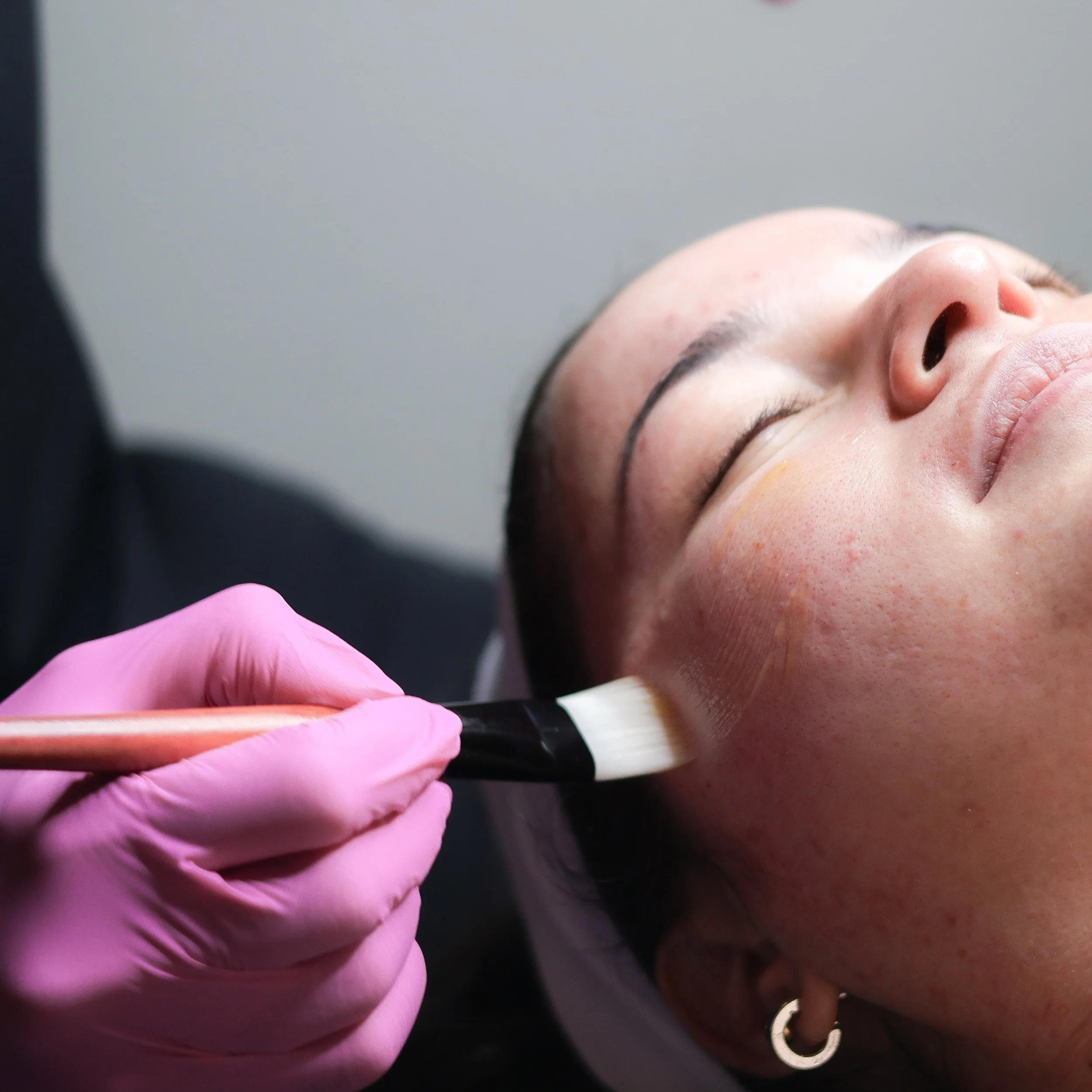 A person receiving a cosmetic treatment with a small vial of liquid, a brush, and gloved hands, with a woman lying down with her eyes closed.