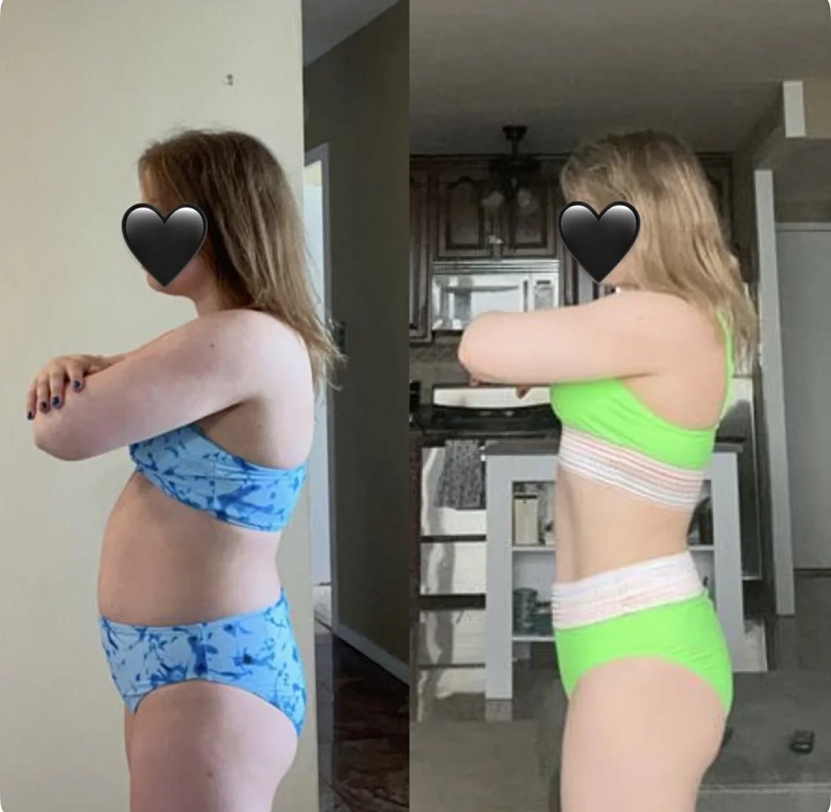 Side-by-side comparison of a woman before and after weight loss, with her arms crossed and faces obscured by black hearts, in different settings.