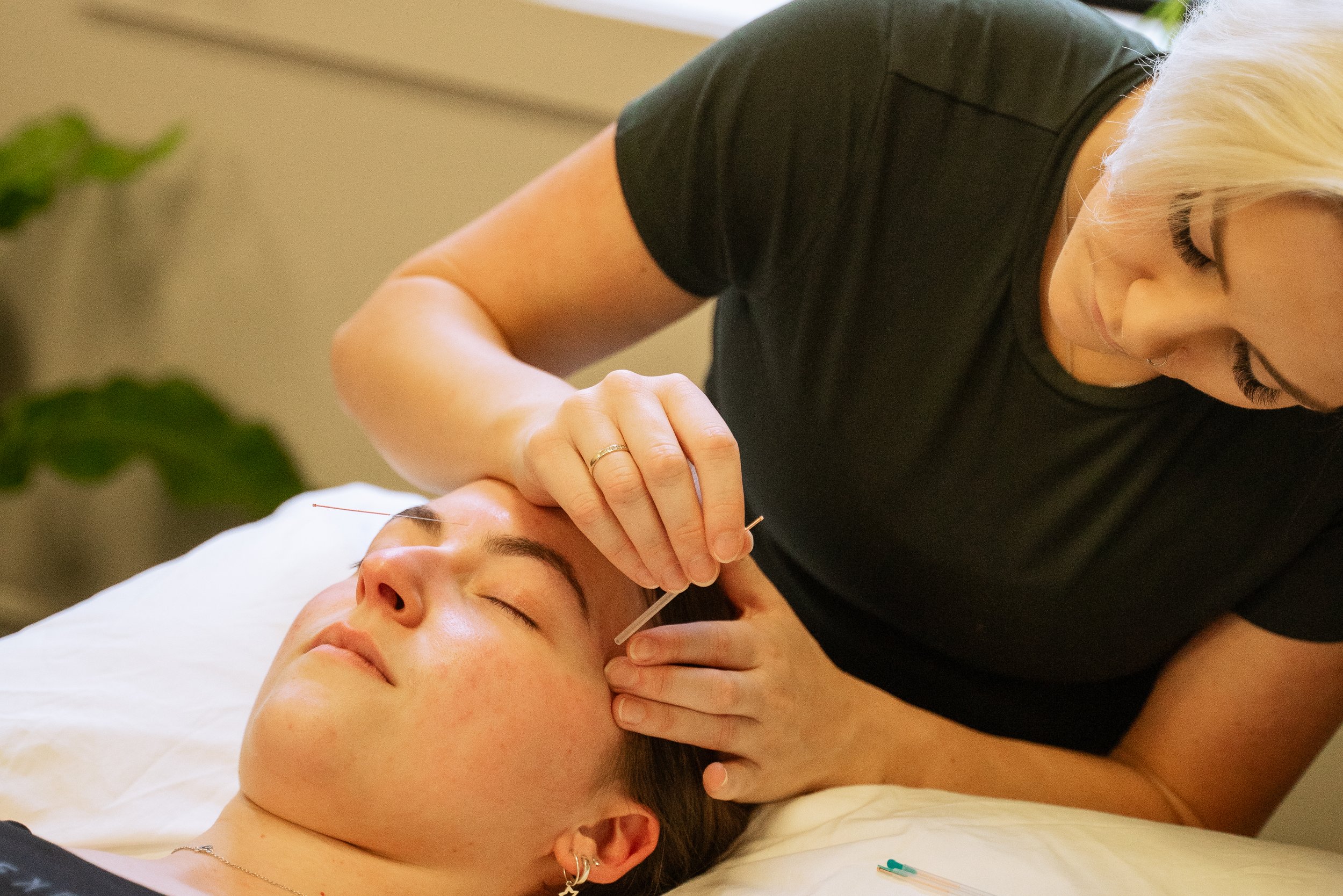 A woman is performing acupuncture on a young woman lying down with her eyes closed.