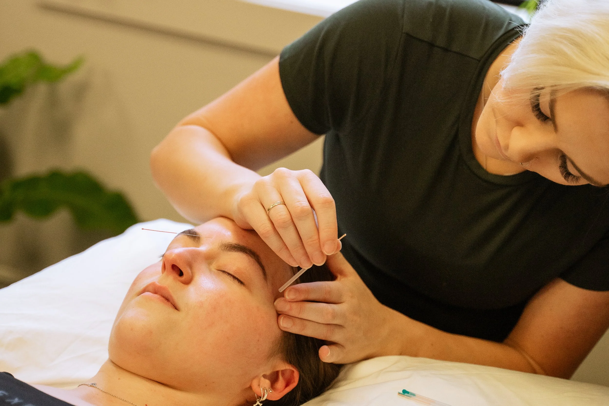 A woman performing an acupuncture treatment on a young woman lying down with her eyes closed.