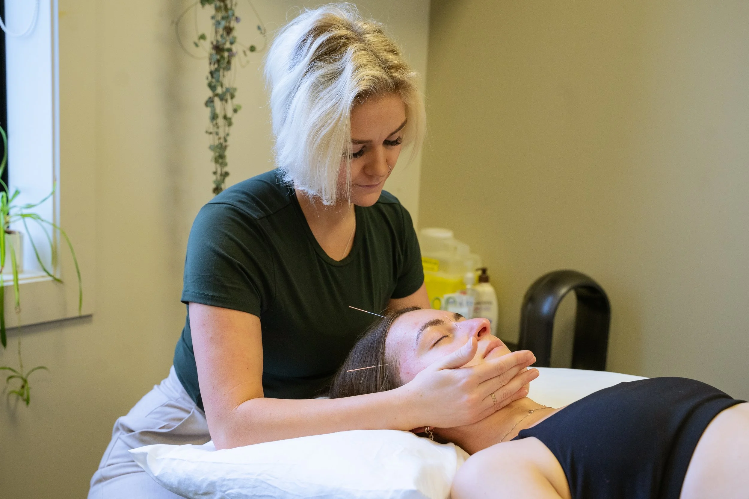 A woman receiving acupuncture treatment from a practitioner in a clinical setting. The woman is lying down with her eyes closed, and the practitioner is inserting thin acupuncture needles into her face and neck.