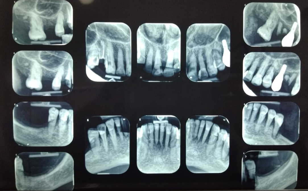 Radiografía seriada