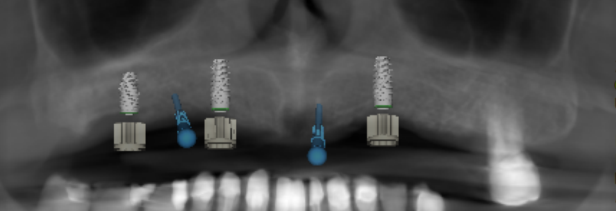 Captura de pantalla 2025-11-12 111310.png