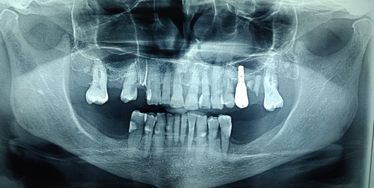 Radiografía panorámica