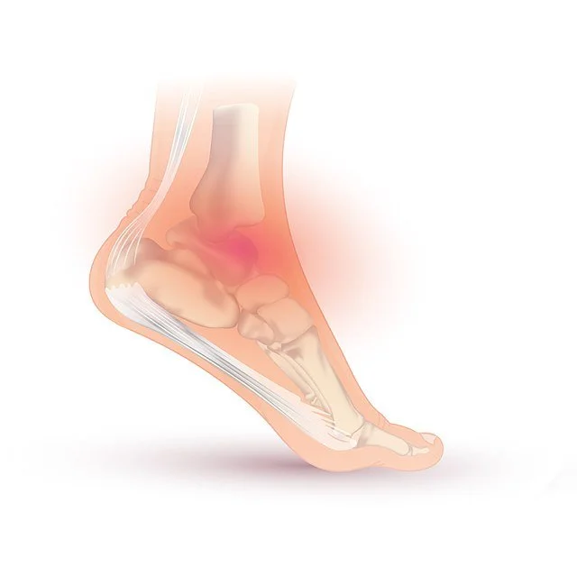 Side view illustration of a human foot showing bones, tendons, and a red area indicating inflammation or pain.