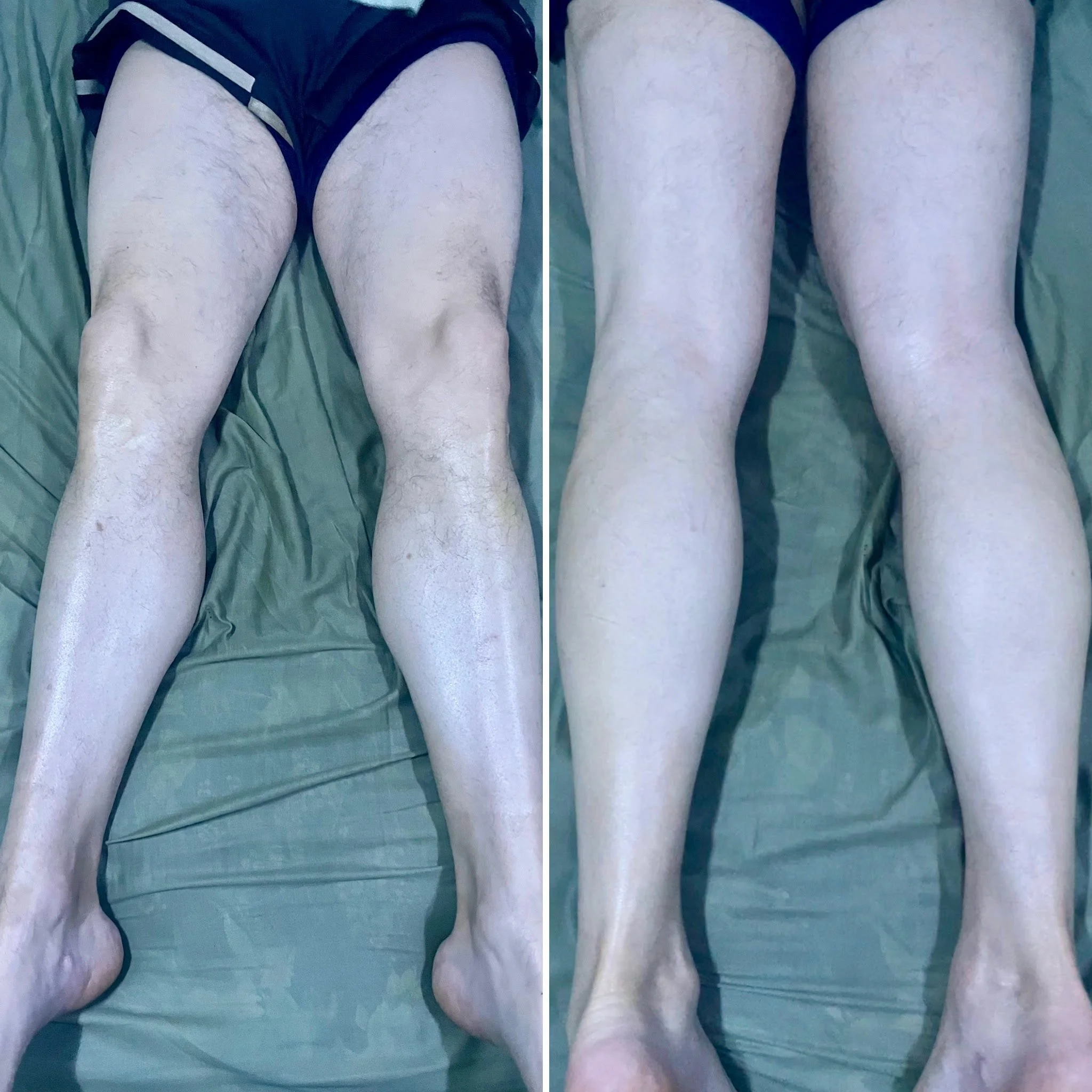 After: Skin Saver Salve facilitated the skin's healing process, restoring smooth, healthy skin.
