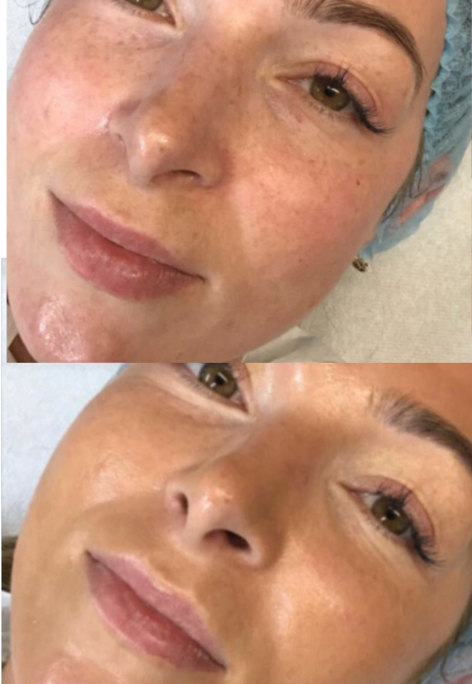 BB Glow Foundation in Basingstoke Clinic