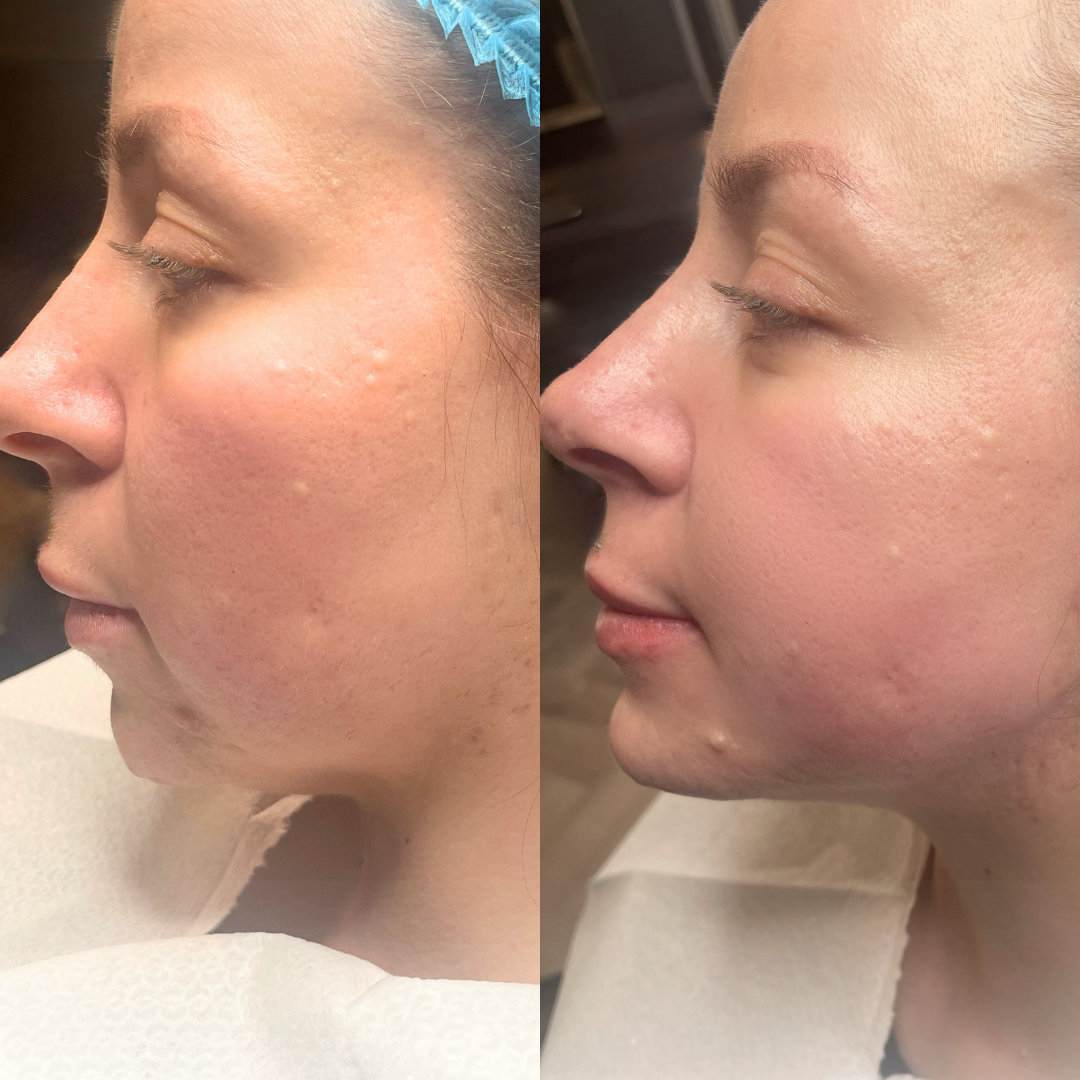 Before and after Template 2 - 1.png