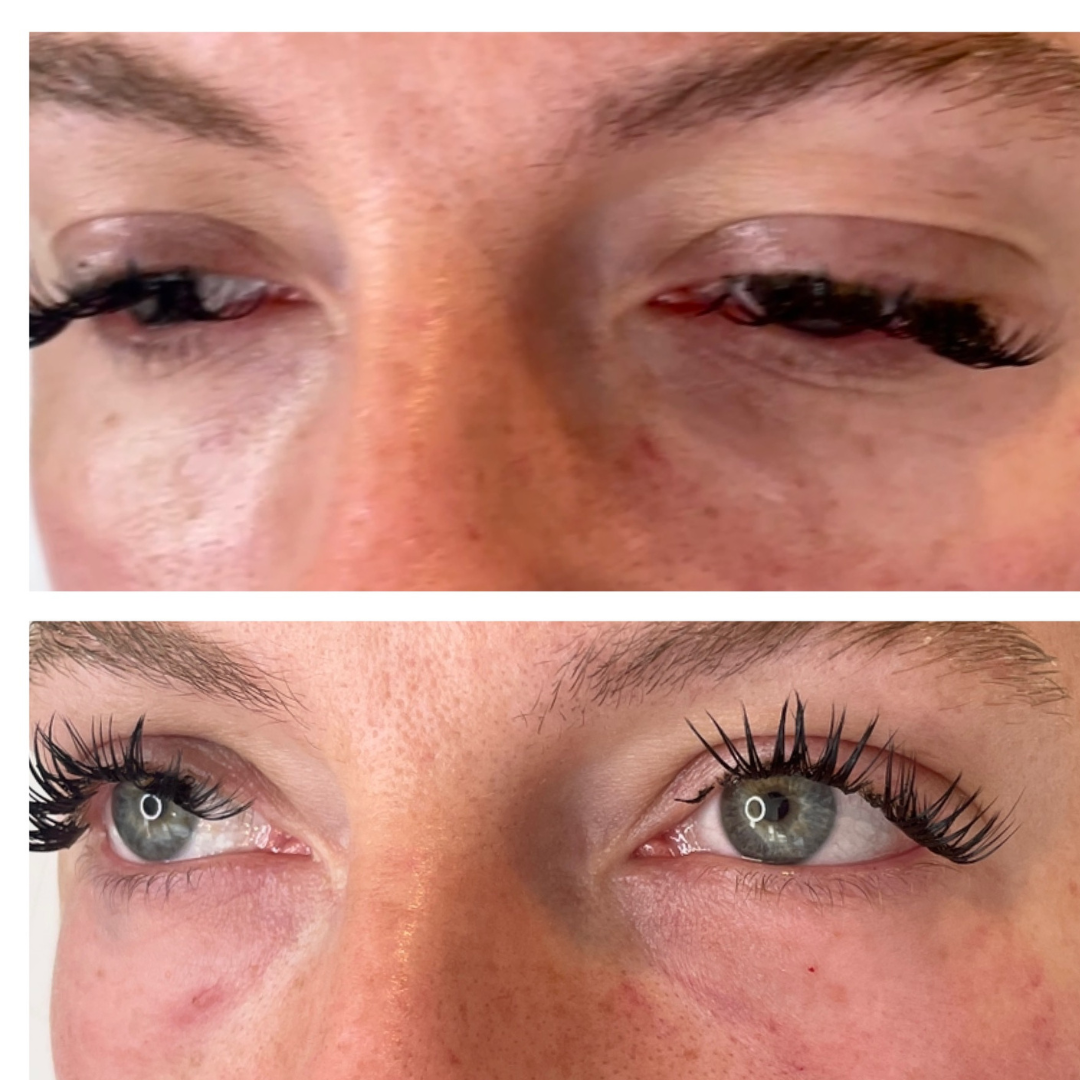 Sunekos eye boosters, lumi eye results Basingstoke