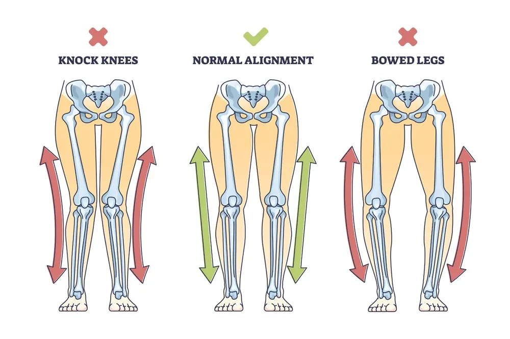 Minding Your Knees: Where Alignment Begins