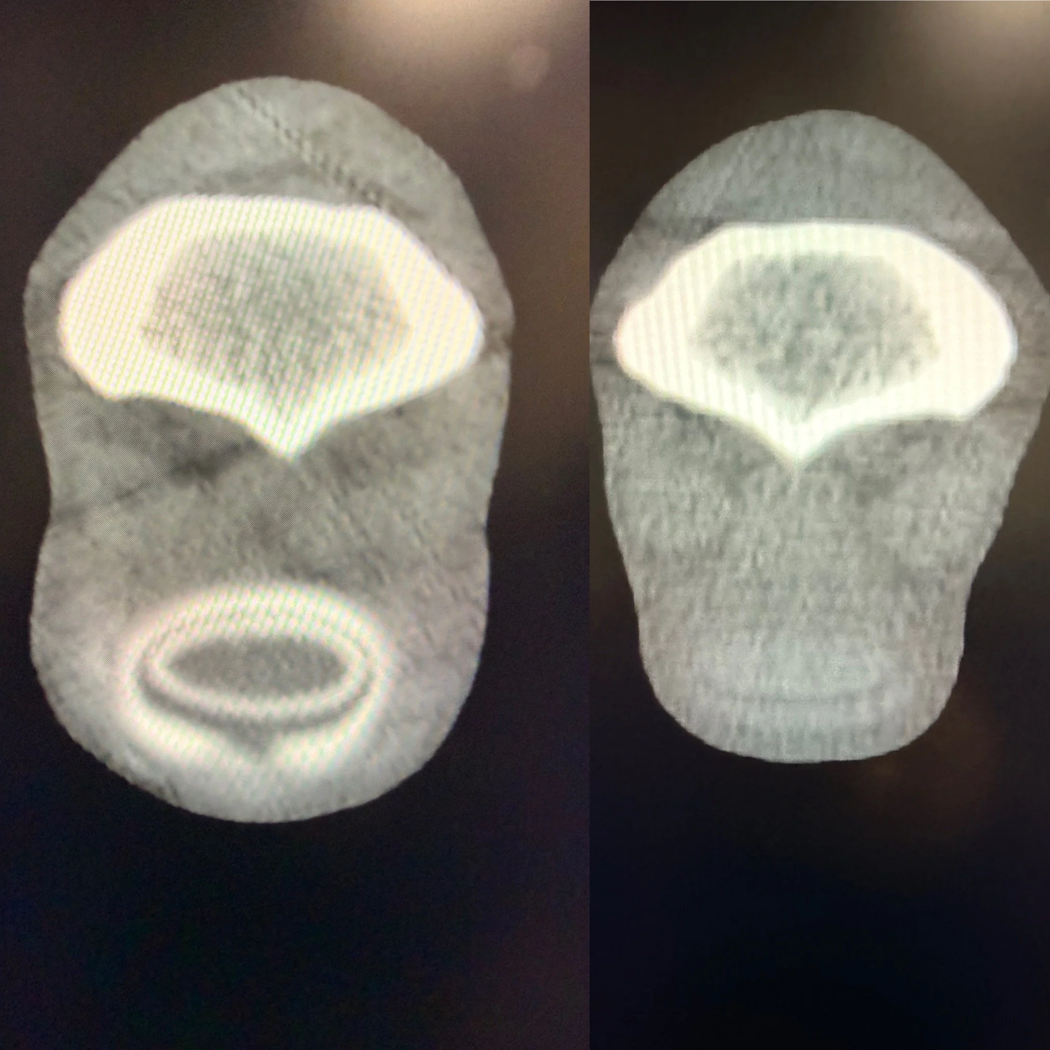 Close-up of the soles of two gray slippers with raised white patches on the heel and toe areas, shown from above against a dark background.