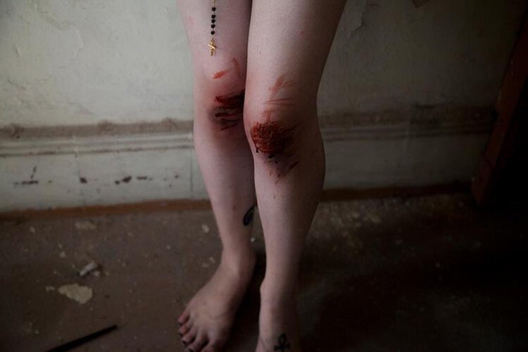 A person's legs with multiple severe bruises, cuts, and abrasions, some of which are swollen and inflamed, along with a stick-on ankh tattoo on one ankle, standing on a damaged floor with peeling paint and debris.