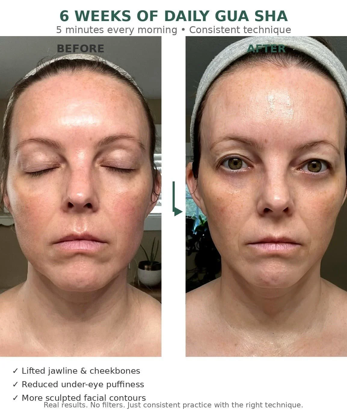 Gua Sha Before And After Real Results My 6 Week Journey Skin Soul gua-sha-before-and-after-real-results-my-6-week-journey-skin-soul