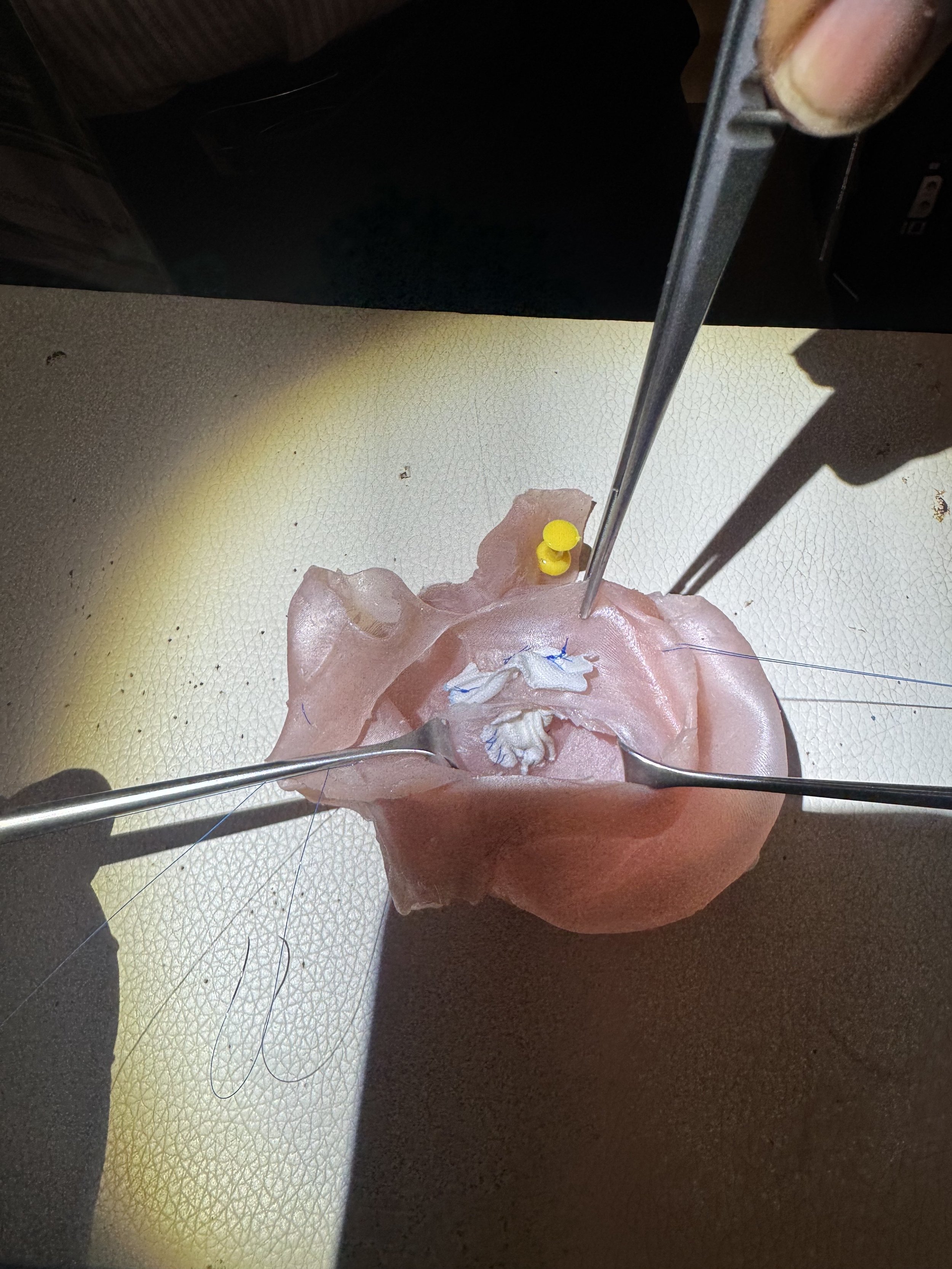 VSD Models Support Congenital Heart Training in Ilorin, Nigeria