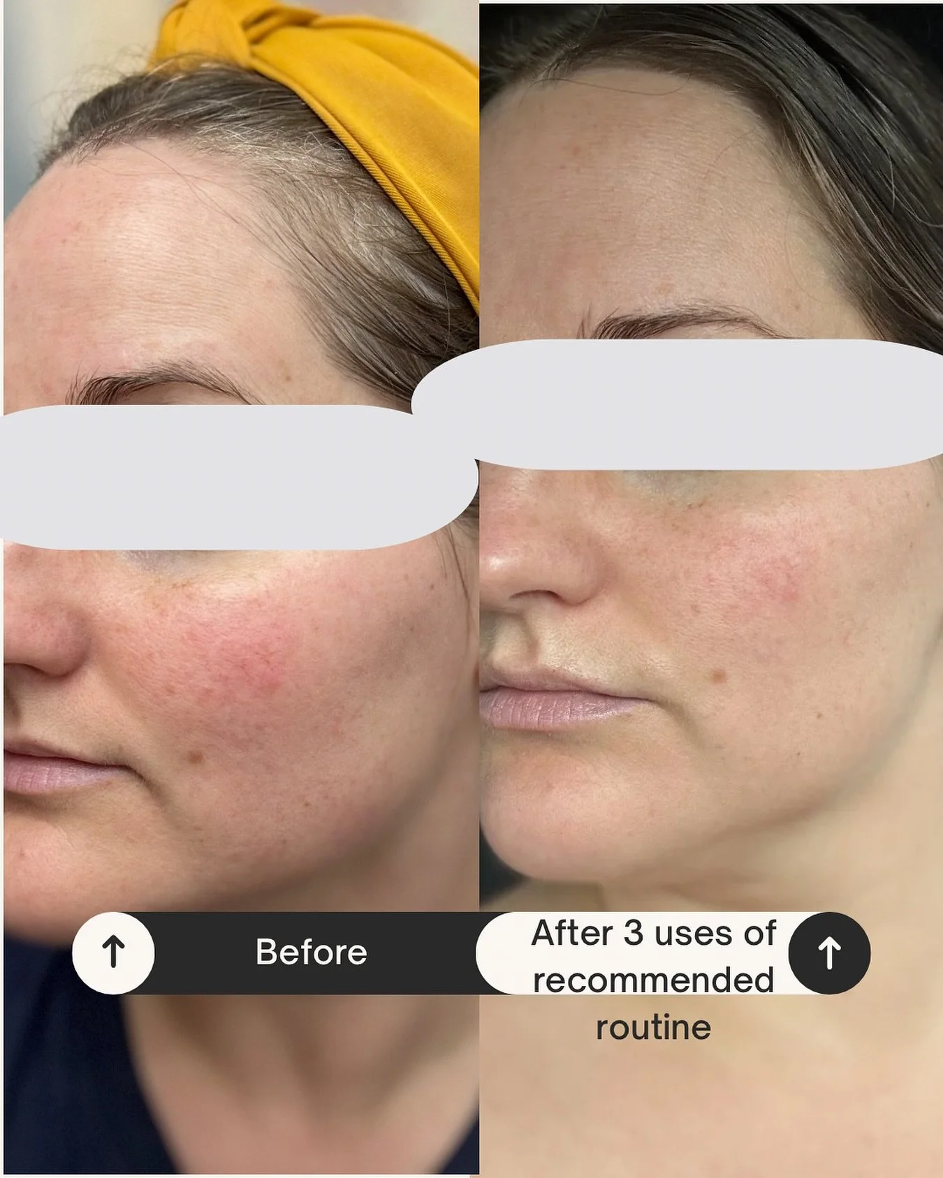 Can&rsquo;t find the time to book a facial, but still have skin goals? DM me any we can set up the time to create a routine that will get you there 🤍