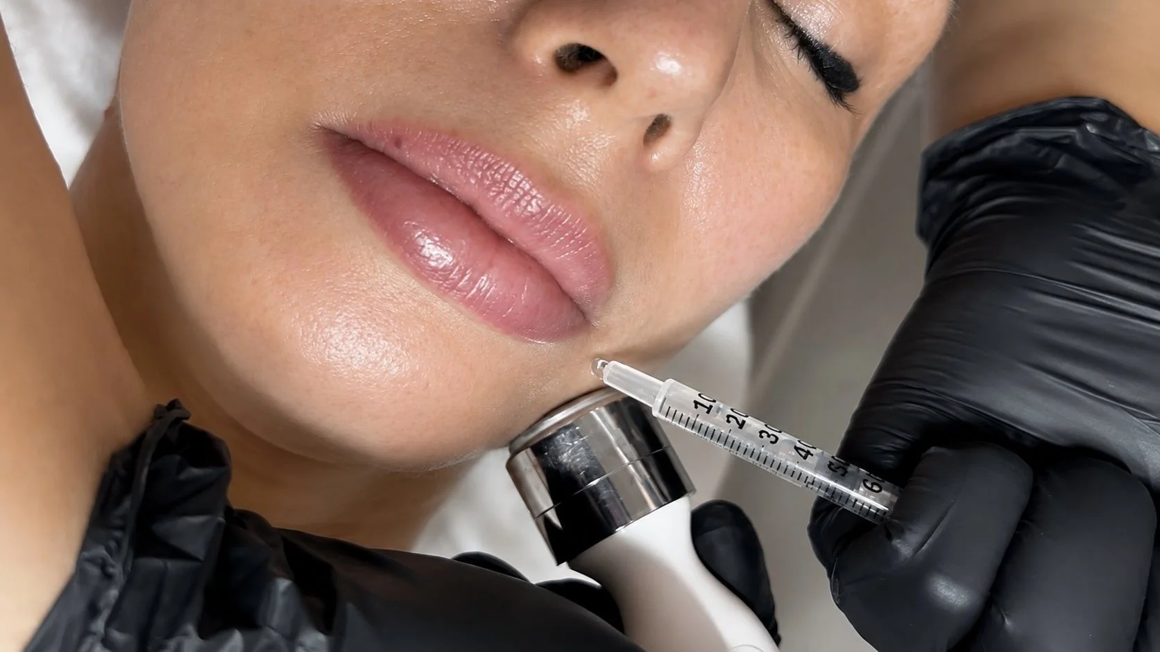 Peeling &amp; Skinbooster 