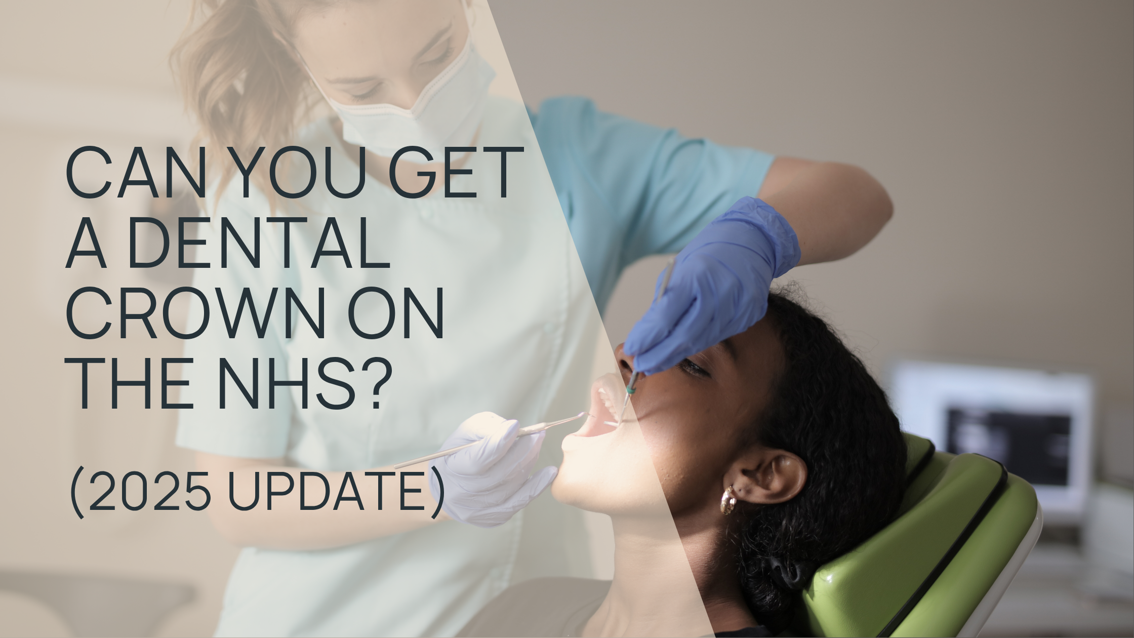 Can You Get a Dental Crown on the NHS? (2025 Update)
