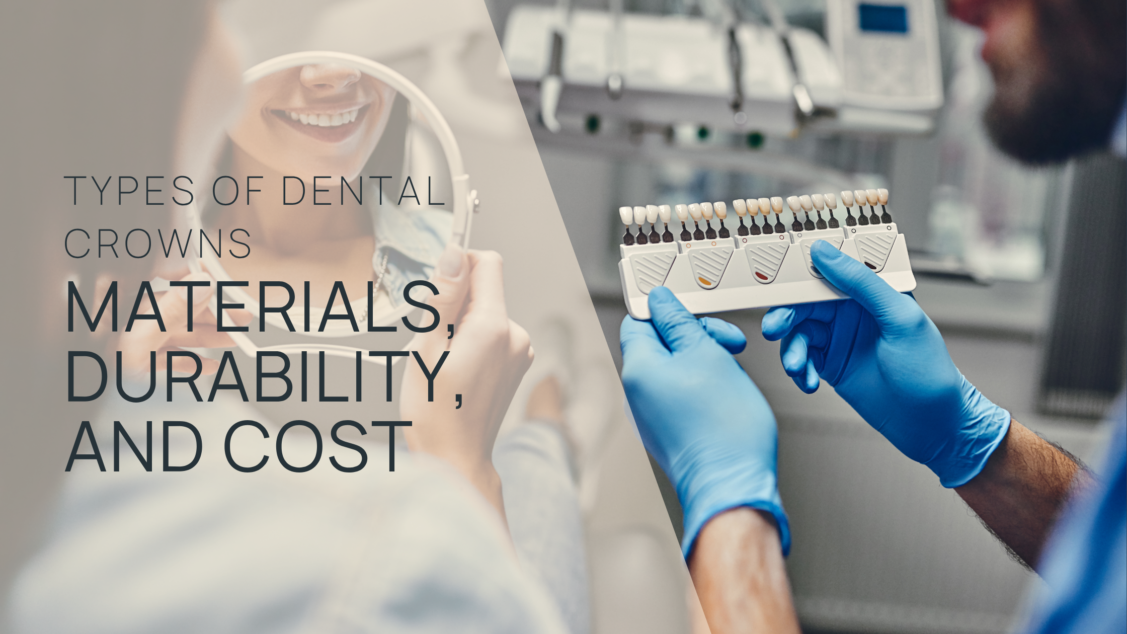 Types of Dental Crowns: Materials, Durability, and Cost