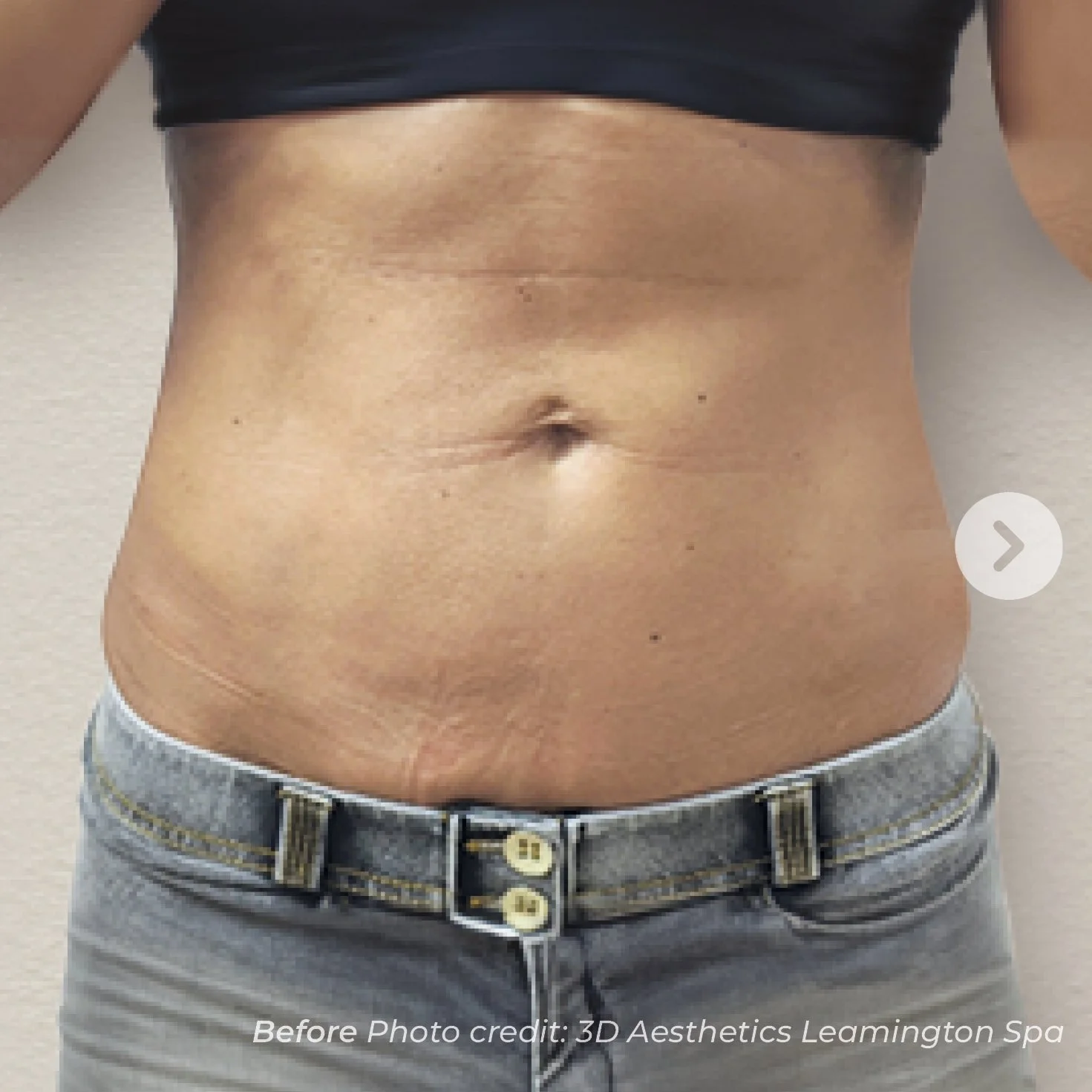 Close-up of a woman's midsection showing toned abdominal muscles and a navel, wearing a black top and light blue jeans.