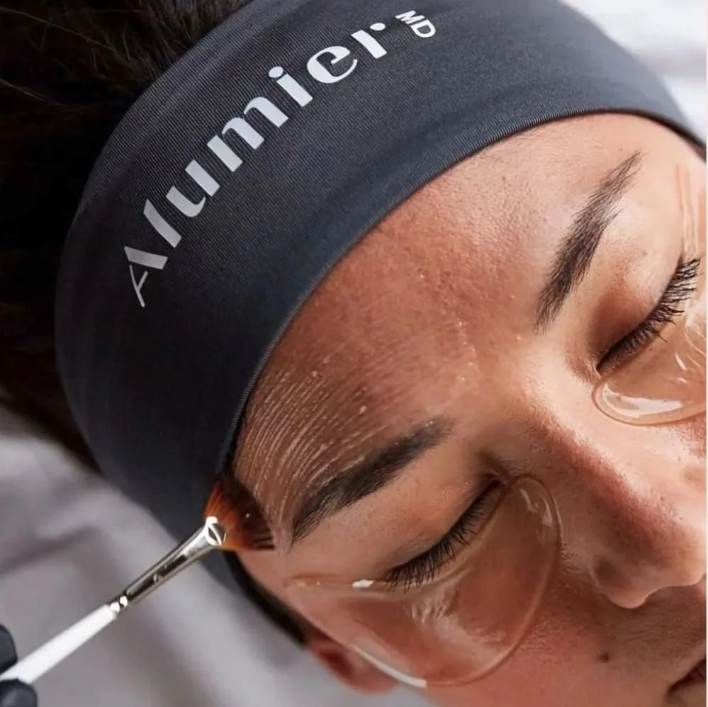 Affordable Facial Peeling Treatment in Ascot