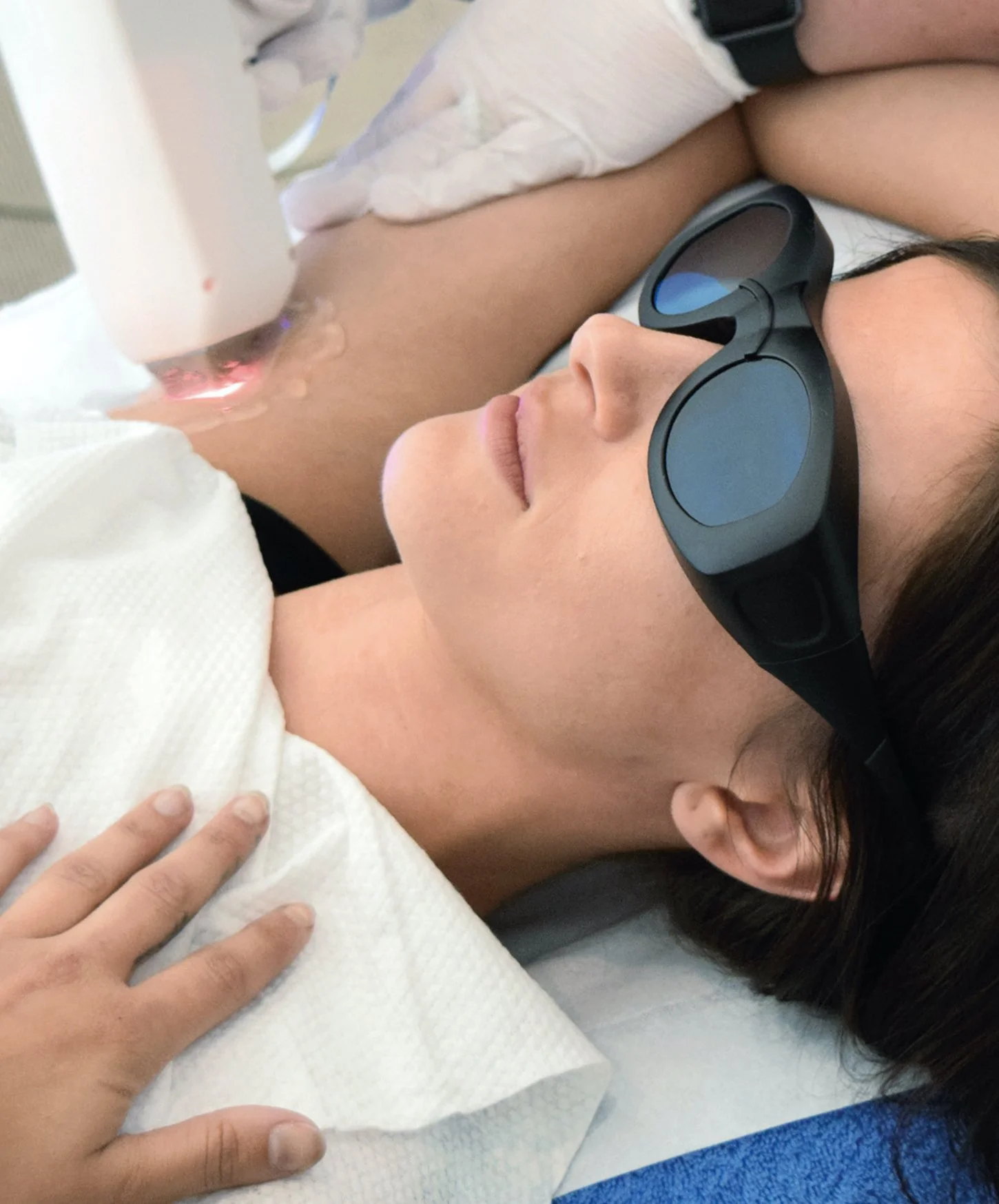 laser hair removal procedure in ascot, UK.