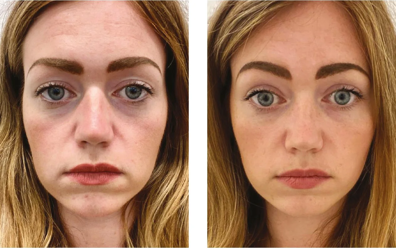 Side-by-side comparison of a woman with red hair showing her face before and after makeup application.
