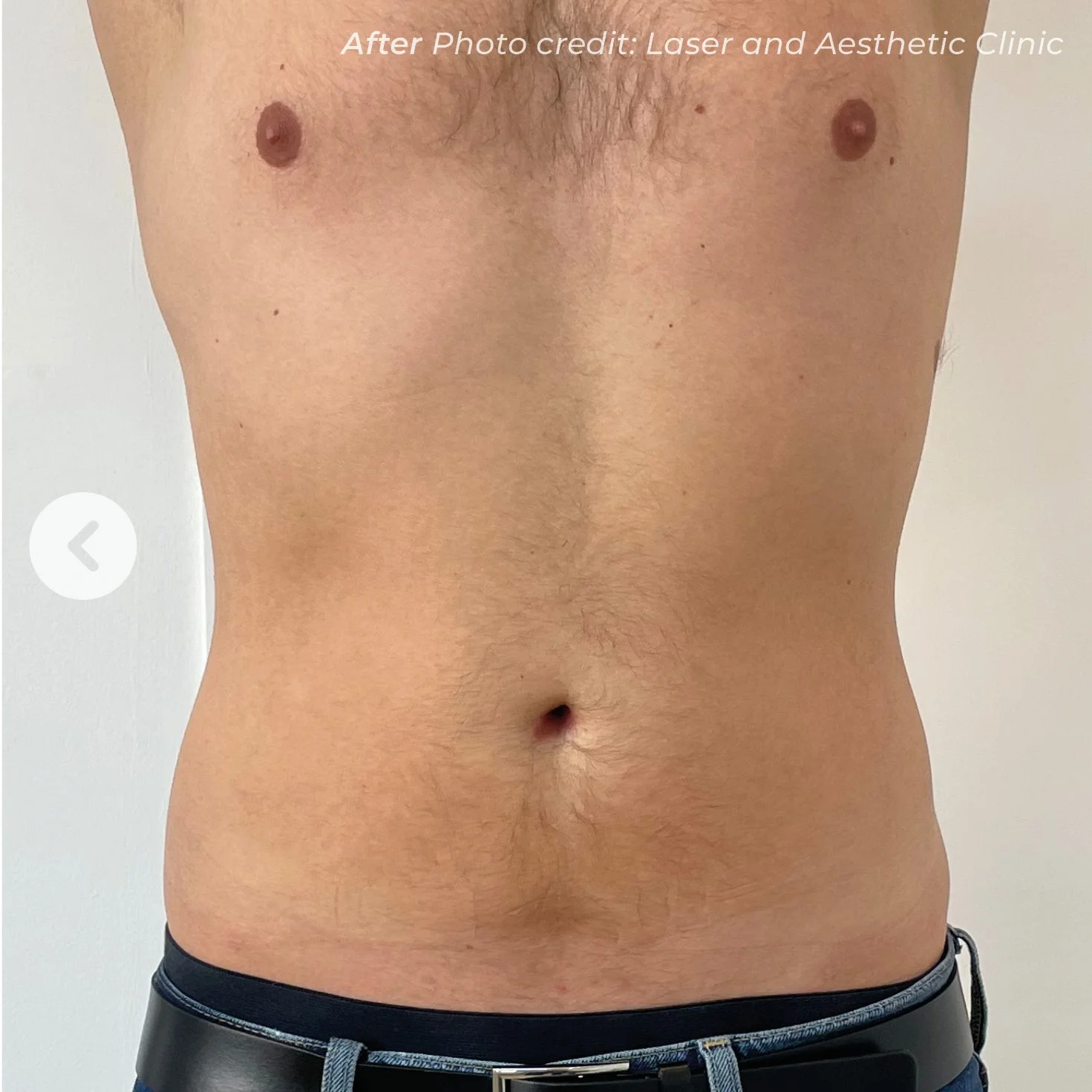 Close-up of a male abdomen with a flat stomach, some chest hair near the upper part of the image, and wearing dark pants with a belt.