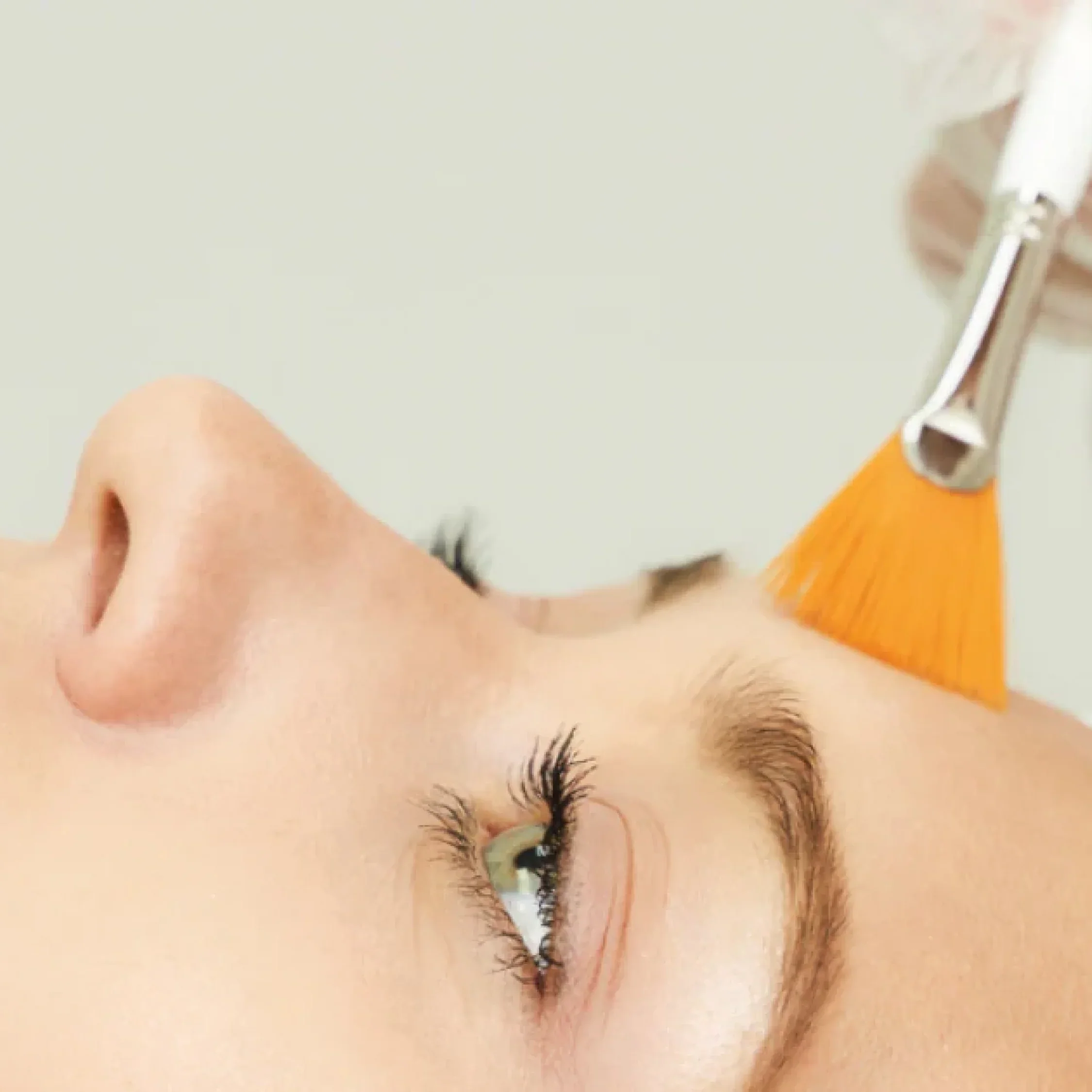 What is facial peeling treatment?