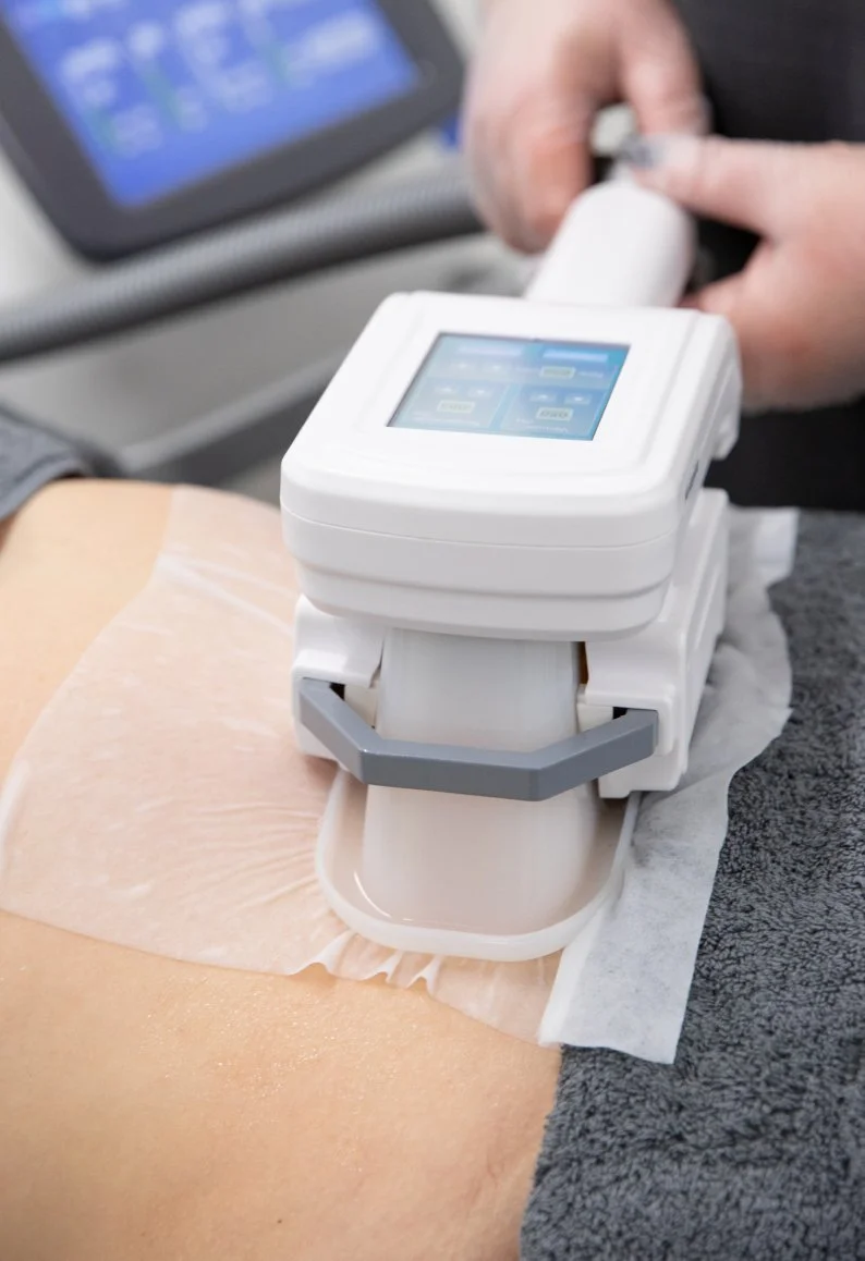 A medical device performing a procedure on a patient with a bandage, with a healthcare professional operating the device, and a monitor screen in the background.
