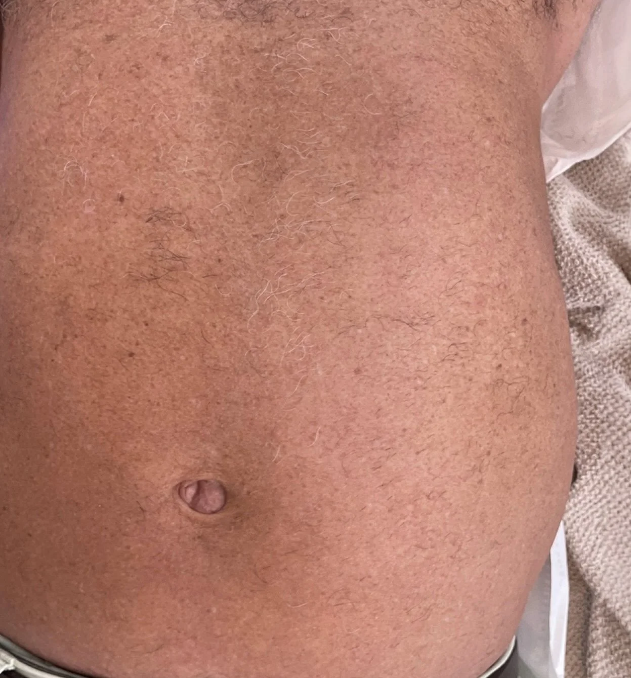 Close-up of a person's abdomen showing brown skin, some hair, and a navel.