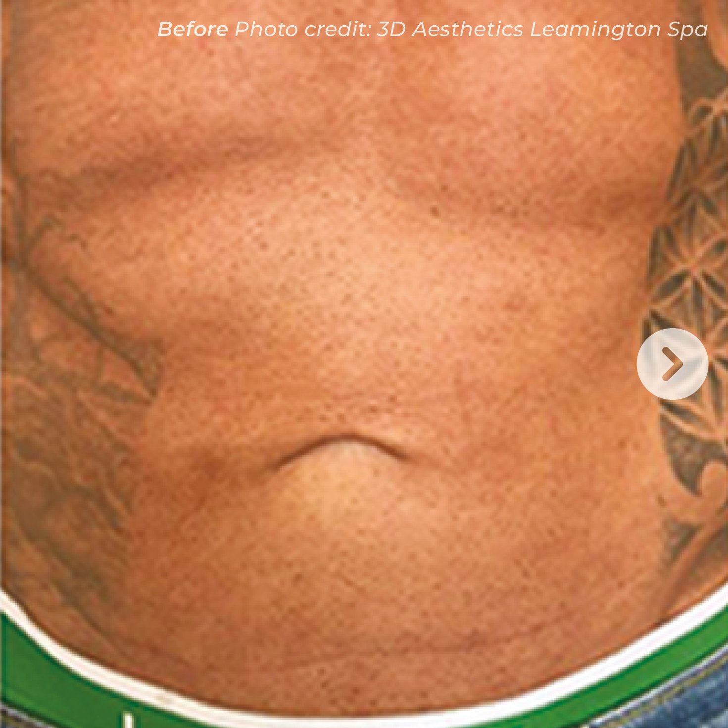 Close-up of a person's lower face, showing a tattooed neck and chin with a small, curved mouth.